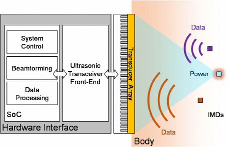 ultrasound_power.gif